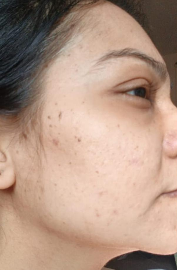 After Beauty Reaction