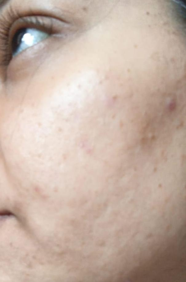 Before Beauty Reaction